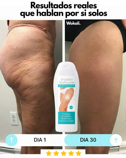 Wokali Alta Cosmética: Tratamiento para Celulitis, Flacidez, Arrugas y Reafirmante - 200 ML.