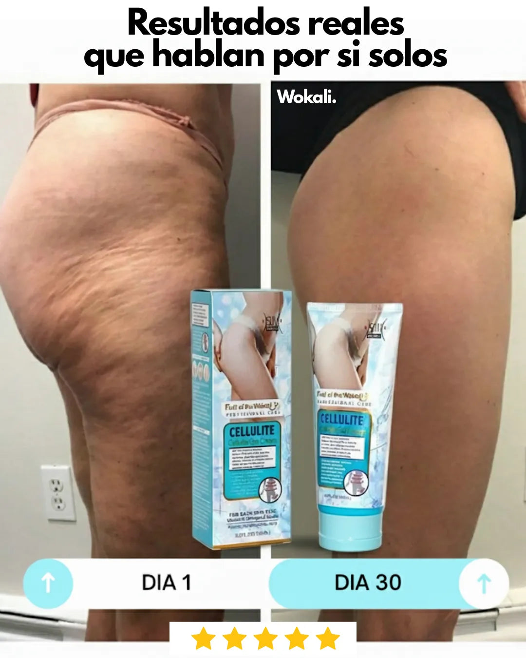 Wokali Alta Cosmética: Tratamiento para Celulitis, Flacidez, Arrugas y Reafirmante - 150 ML.