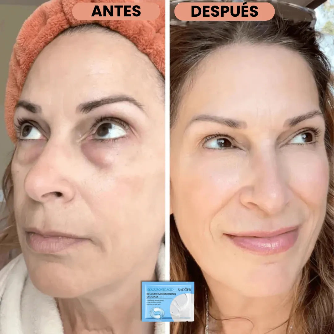 Parches MicroGlow de NovaLift