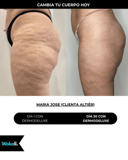 Wokali Alta Cosmética: Tratamiento para Celulitis, Flacidez, Arrugas y Reafirmante - 150 ML.