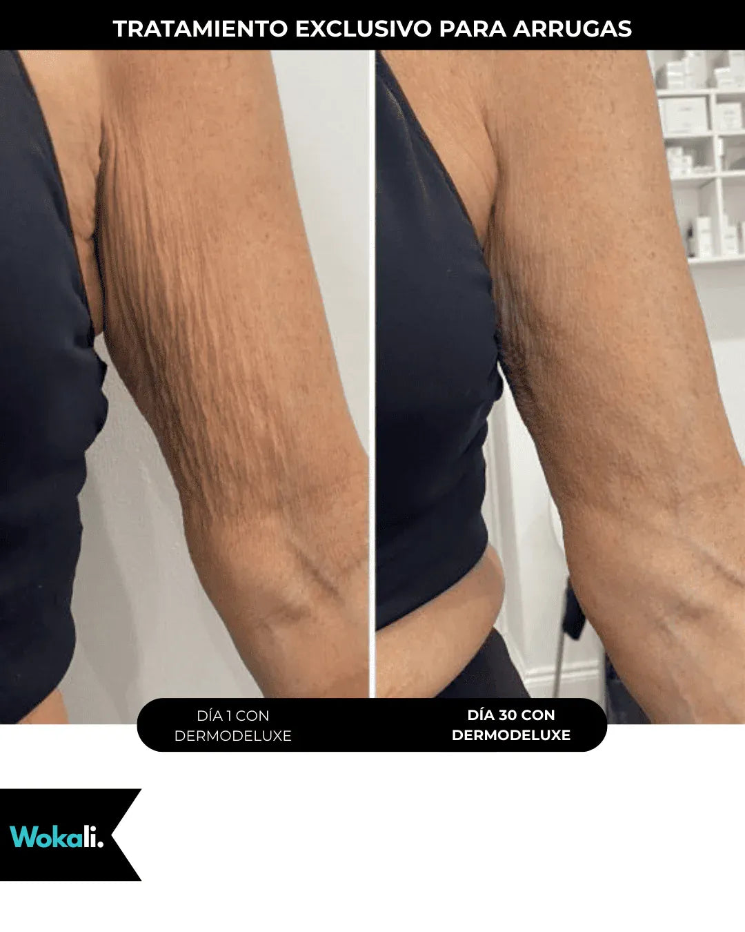 Wokali Alta Cosmética: Tratamiento para Celulitis, Flacidez, Arrugas y Reafirmante - 150 ML.