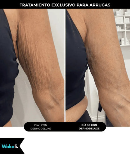 Wokali Alta Cosmética: Tratamiento para Celulitis, Flacidez, Arrugas y Reafirmante - 150 ML.