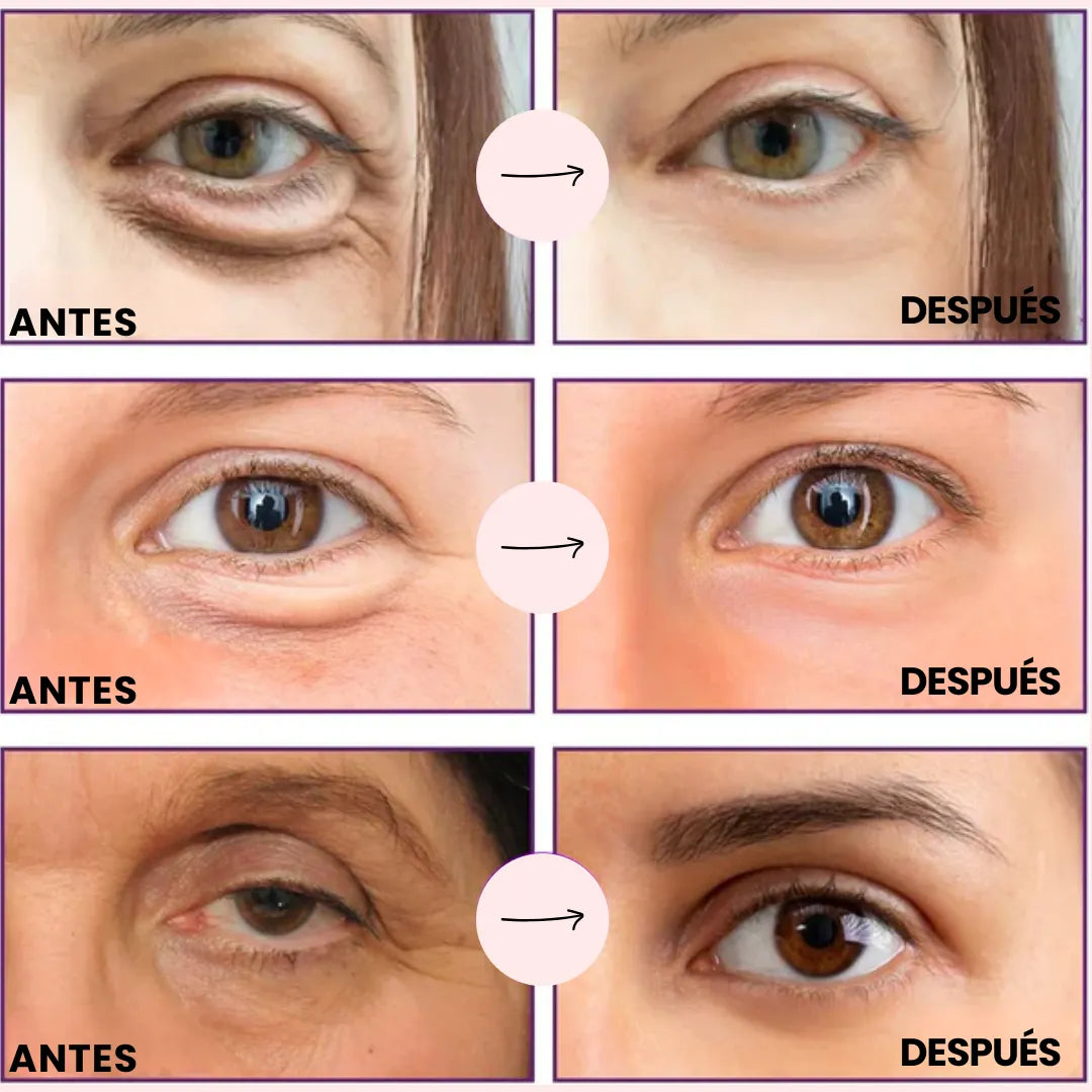 Parches MicroGlow de NovaLift