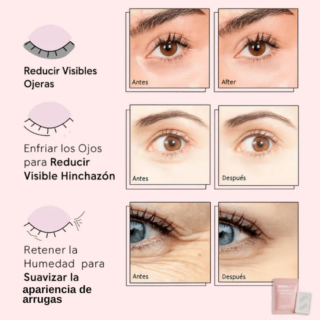 Parches MicroGlow de NovaLift