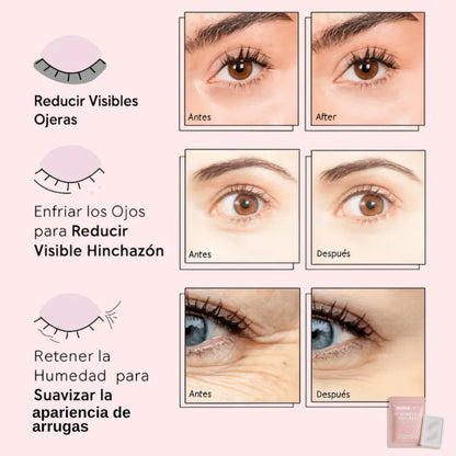 Parches MicroGlow de NovaLift